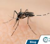 Las 5 picaduras de insectos más comunes en verano